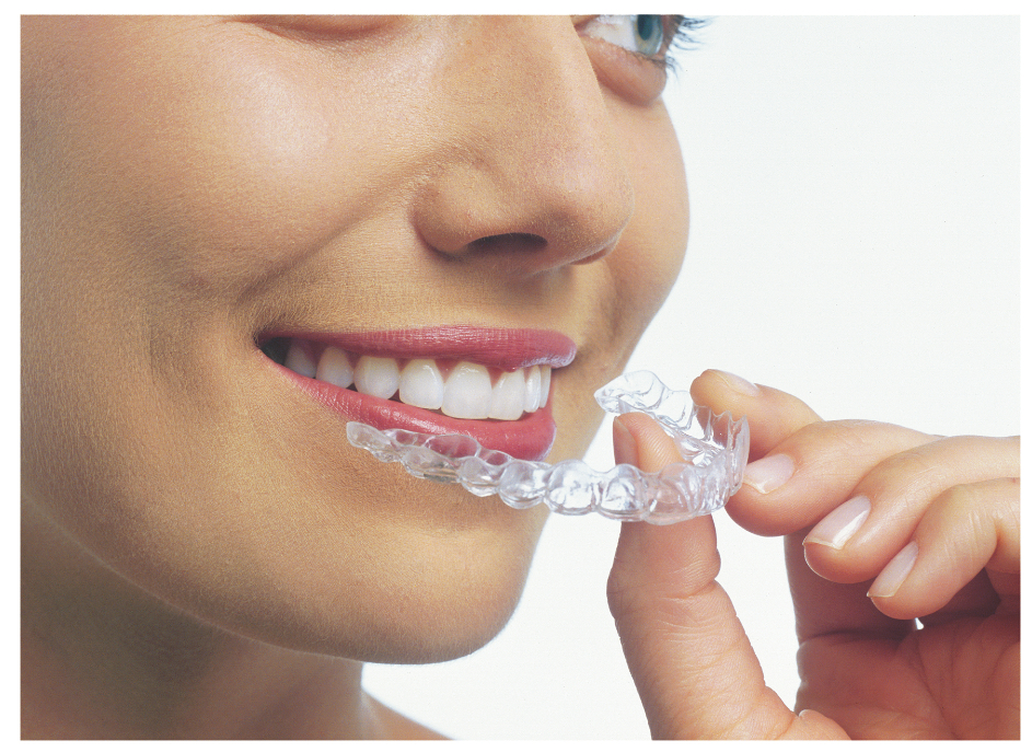 Allergy to InvisalignÂ® are 3 words no dental patient wants to hear.