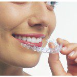 Smiling girl holding invisalign in vancouver location