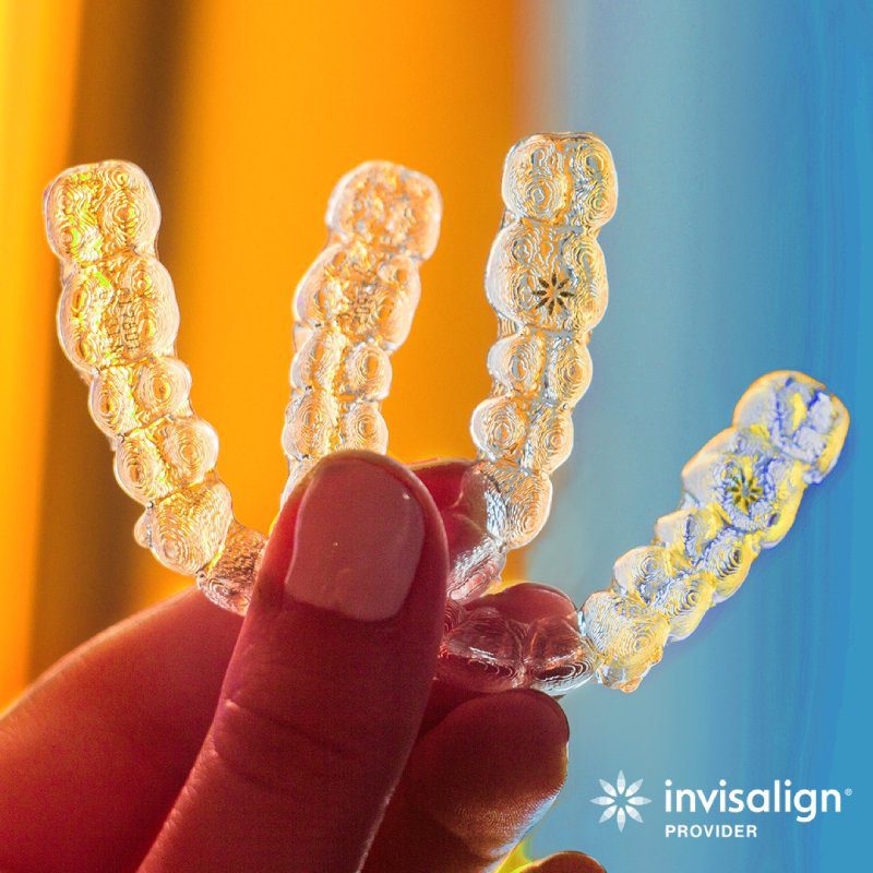 holding invisalign in Vancouver
