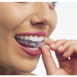 women holding invisalign in downtown vancouver